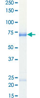 Loading 1 &mu;g protein in SDS-PAGE